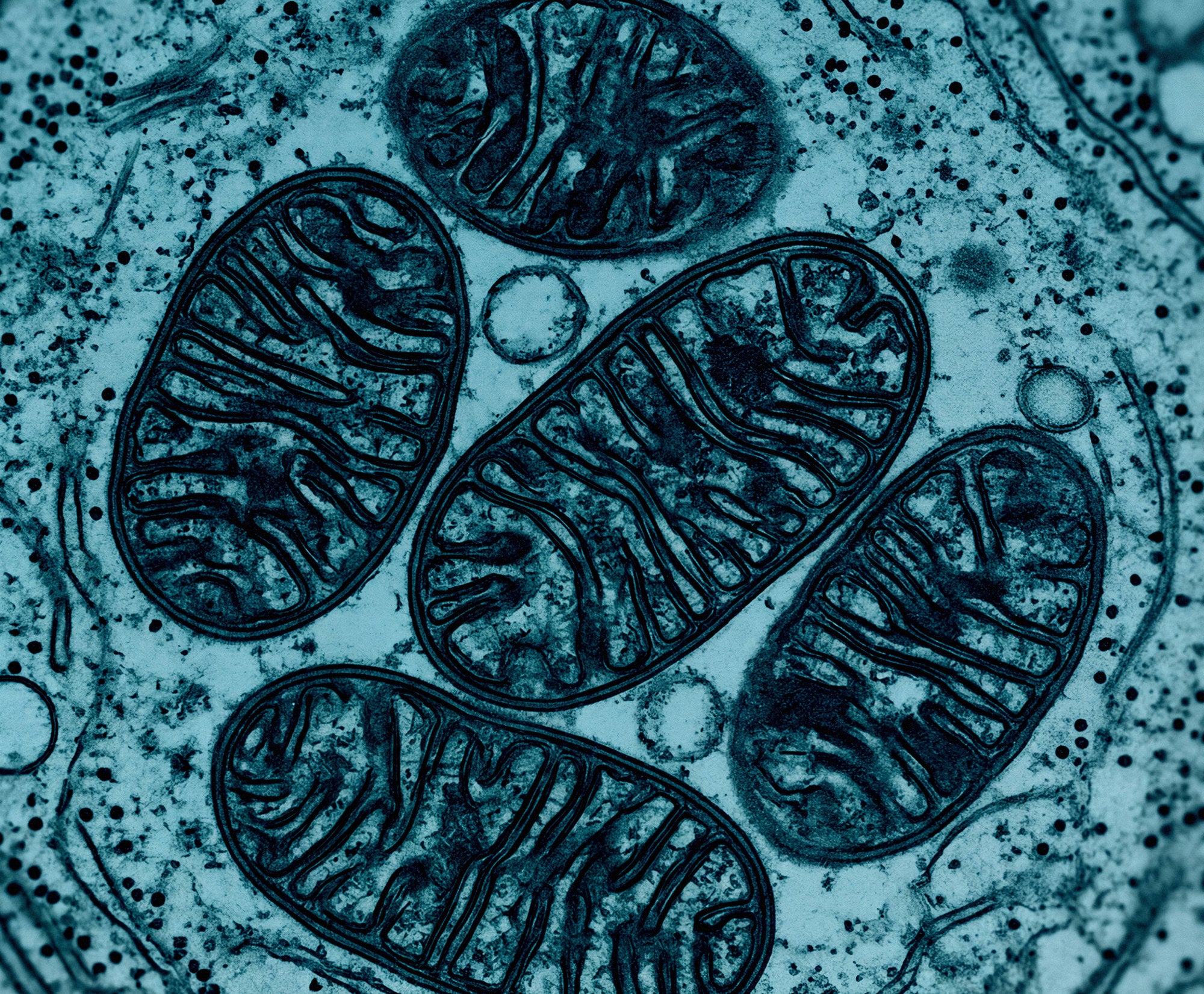 An electron micrograph of mitochondria inside a cell